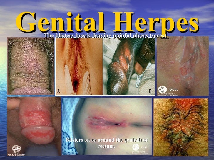 Mobile extreme interracial fucking Erotic hypnosis subliminal